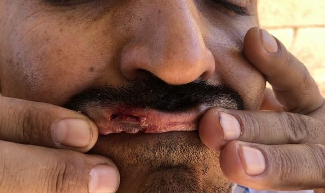 Türk Veteriner Hekimleri Birliği Merkez Konseyi Başkanı Ali Eroğlu, Suruç