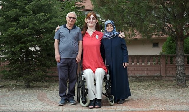 Karabük'ün Safranbolu ilçesinde yaşayan Weaver Sendromu rahatsızlığı bu...