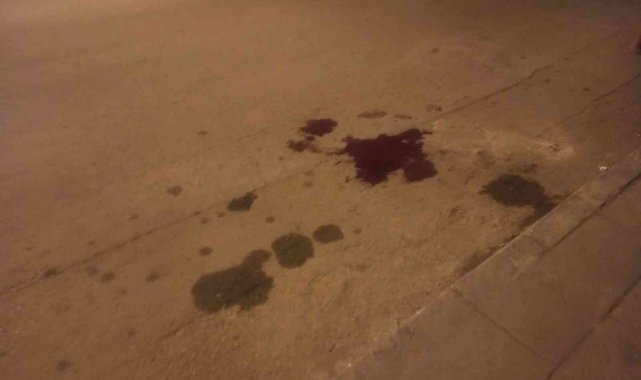 Ankara'nın Sincan ilçesinde silahlı saldırı sonucu iki bacağından vurul...