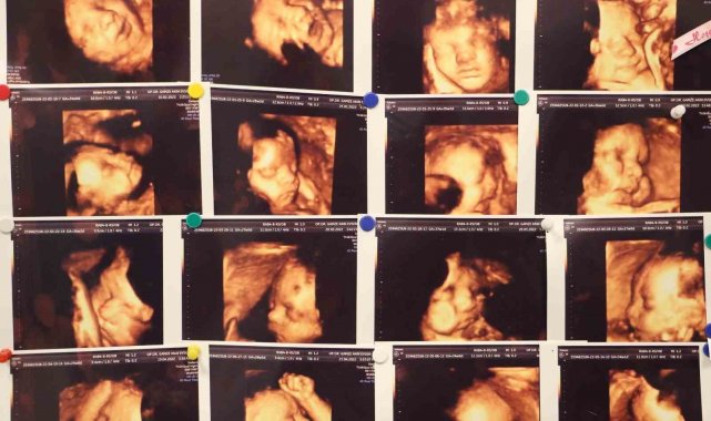 Memorial Hastanesi Kadın Hastalıkları ve Doğum Uzmanı Op. Dr. Gamze Akın Ev...