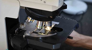 Temas ile bulaşıyor, sayısı her geçen gün artıyor