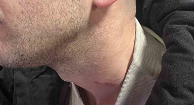 Yeşil saha boks ringine döndü