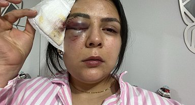 Yürürken saldırıya uğrayan genç kız konuştu: "Psikolojim altüst oldu"