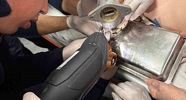 2 yaşındaki çocuk elini kıyma makinesine kaptırdı