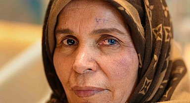 'Göremezsin' denilen Libyalı Kadın Türkiye'de aydınlığa kavuştu