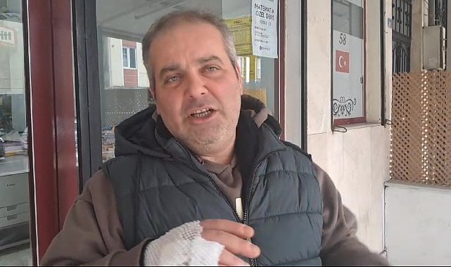 Başıboş pitbull, köpeği parçaladı, 1 kişi de yaralandı: Dehşet anları kamerada