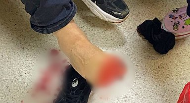 Uyuşturucu operasyonunda polise silahla ateş açıldı: 2 polis yaralandı