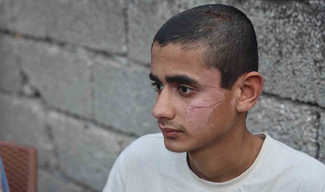 Altı kişinin öldüğü kazada yaralı kurtulan 17 yaşındaki çocuk, "Kazayı hatırlamak istemiyorum, kötü oluyorum"