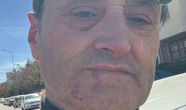 Ankara'da eylem yapan grup başıboş köpeklerin toplanmasına destek veren vatandaşın burnunu kırdı