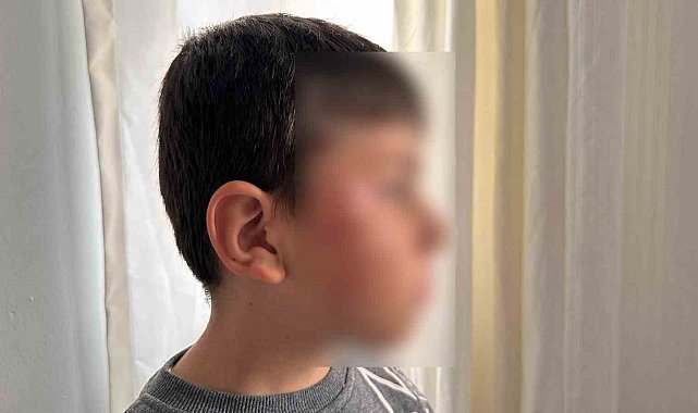 Bursa'da ilkokulda dayak skandalı