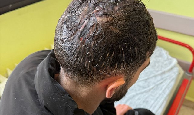 Edirne'de iş kazasında hafızasını kaybetti: Sadece annesini hatırlıyor