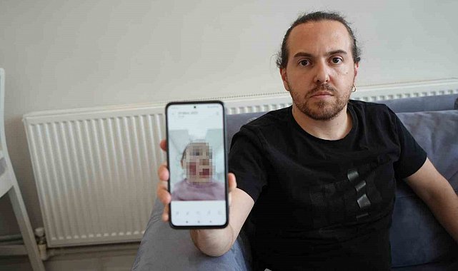 Aile ve Sosyal Hizmetler Bakanlığından, kreşte 2 yaşındaki çocuğun darp olayına ilişkin açıklama