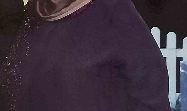 Azmetti 22 ayda 128 kilodan 75 kiloya düştü