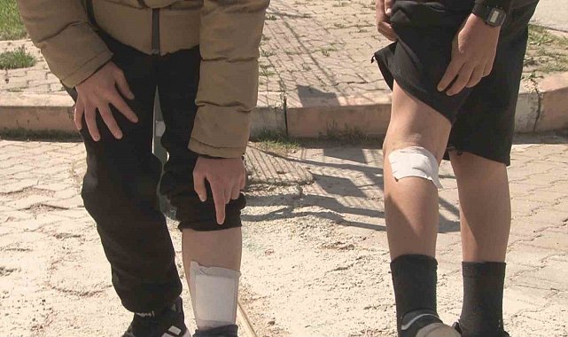 Beslediği sokak köpekleri çocuklara saldırırken seyirci kaldı