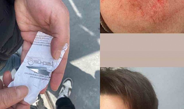 Milli sporcuya eski antrenörü saldırdı; vücudunda çok sayıda kesik oluştu