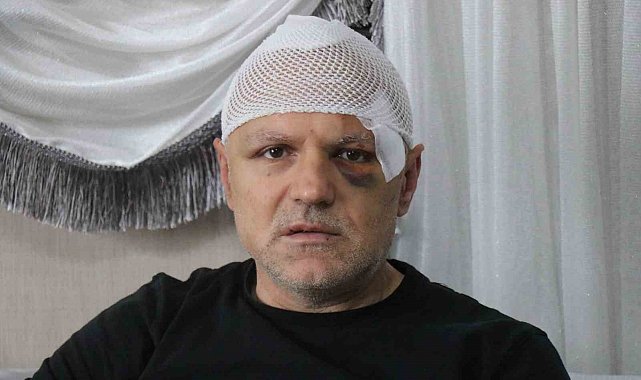 Öldüresiye darp edilen tekel bayii işletmecisi yaşadığı dehşeti anlattı