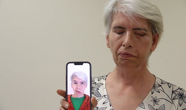 Sol gözünü 41 yıl sonra 24 ayar altınla yapılan tedavi sonucu kapattı