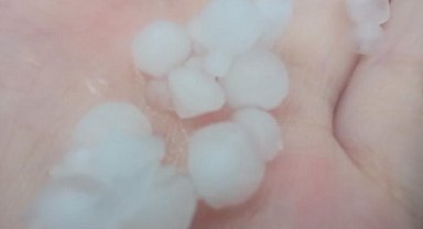 Ankara'da dolu yağışı etkisini sürdürüyor