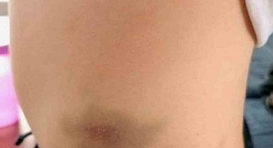 Ankara'da özel okulda akran şiddeti iddiası