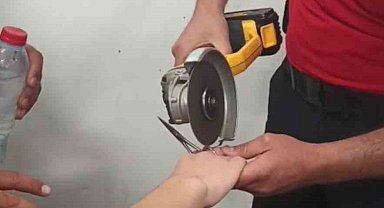 Parmağı makas halkasına sıkıştı, itfaiye kurtardı