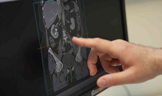 "Erkek sağlığının sırrı sofrada: Beslenmeyle cinsel gücü artırın"