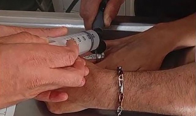 Şırnak'ta vatandaşın parmağına sıkışan yüzük için ekipler seferber oldu