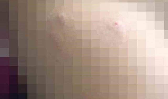 Sokak köpeği 5 yaşındaki çocuğa saldırdı