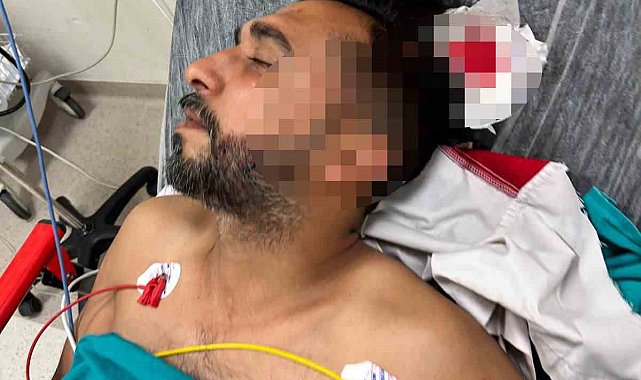 Adana'da döner ustası çalışırken başından yorgun mermiyle yaralandı