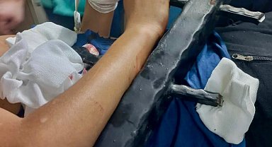 Ağaçtan düşen çocuk korkuluk demirlerine saplandı