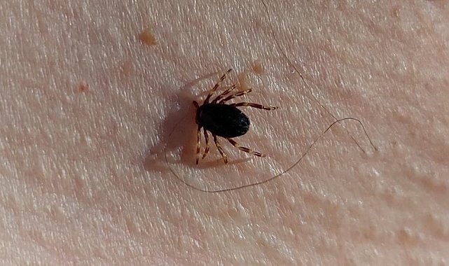 Doğu Karadeniz'de kene mevsimi sakin geçiyor