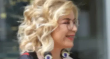 Dudak Dolgusu Ankara: Dolgun, Doğal Gülüşe Ulaşmanın Kolay Yolu