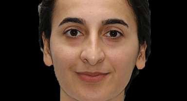 Erzurum'da tedavi gören polis memuru Burcu Ertem vefat etti