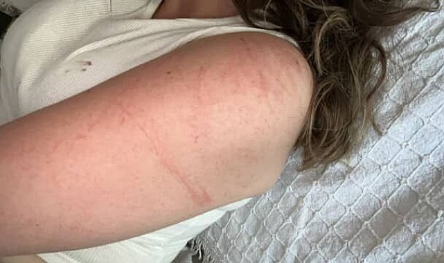 Genç kıza dehşeti yaşatmıştı...Polis yakaladı