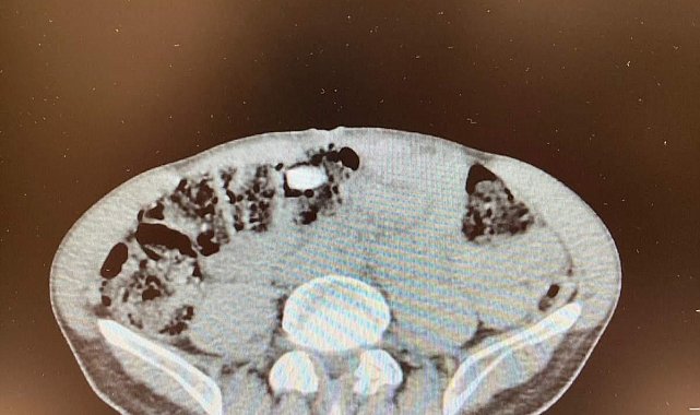 Havayoluyla Denizli'ye gelen yabancı yolcu 1,25 kilo uyuşturucu ile yakalandı