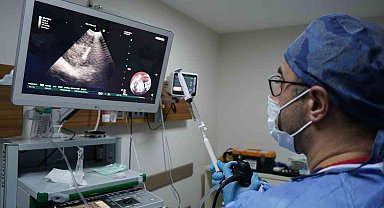 İEÜ Medical Point Hastanesi Akciğer Sağlığı Merkezi'nde EBUS ile ameliyatsız tanı