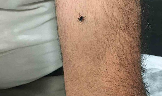 Kayseri'nin bir ilçesinde daha kene vakası