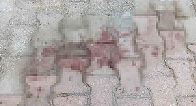 Komşusunun balkonundan kendi evine geçmeye çalışırken düşen kadın ağır yaralandı