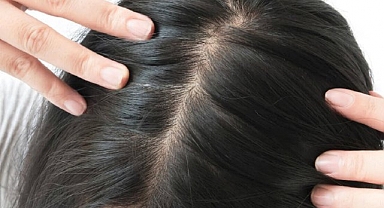 Mevsimsel Saç Dökülmesi Gerçek mi?