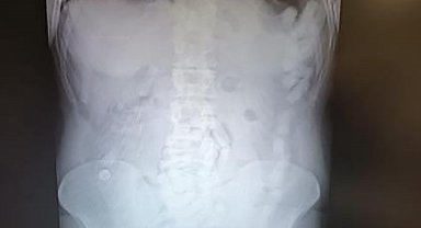 Midesinde uyuşturucu maddeyle yakalanan şahsa 12 yıl hapis cezası