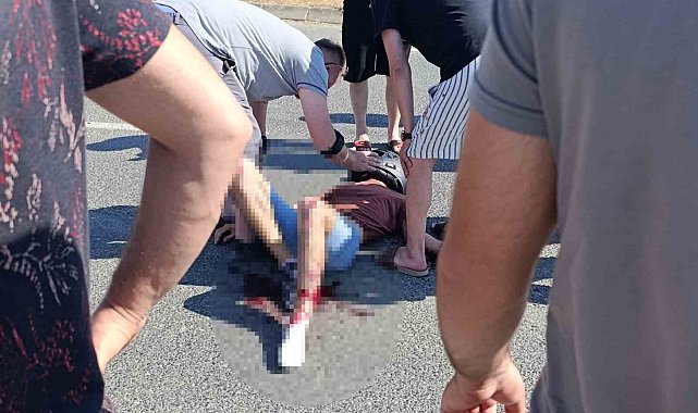 Ordu'da motosiklet ile otomobil çarpıştı: 1'i çocuk 2 yaralı