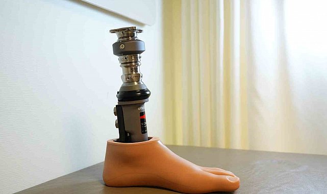 Osseoıntegrasyon sayesinde doğal yürüyüş mümkün