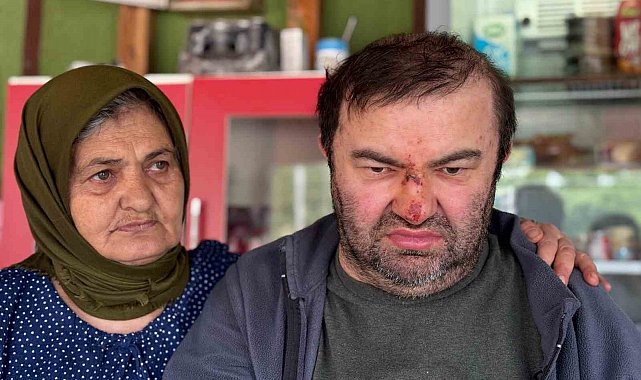 Yüzde 90 engelli vatandaş acımasızca darp edildi