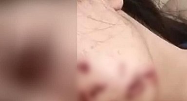 Yüzüne maytap isabet eden genç kız yaralandı