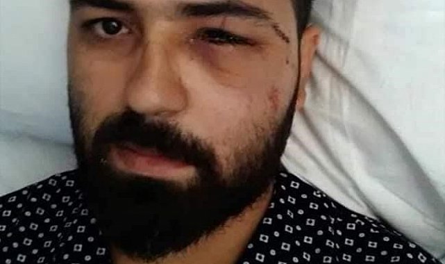 15 Temmuz Gazisi Akkoç: "Darbeci asker dalga geçer bir ses tonu ile 'sen kelime-i şehadet getir' dedi"
