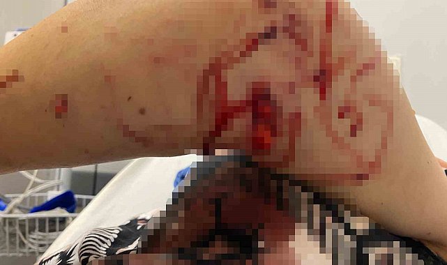 Abdest almak için bahçeye çıkan kadına köpekler saldırdı