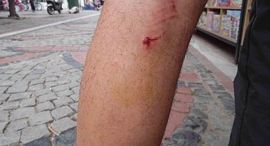 Başıboş 8 köpek, köpeğini gezdiren vatandaşa saldırdı