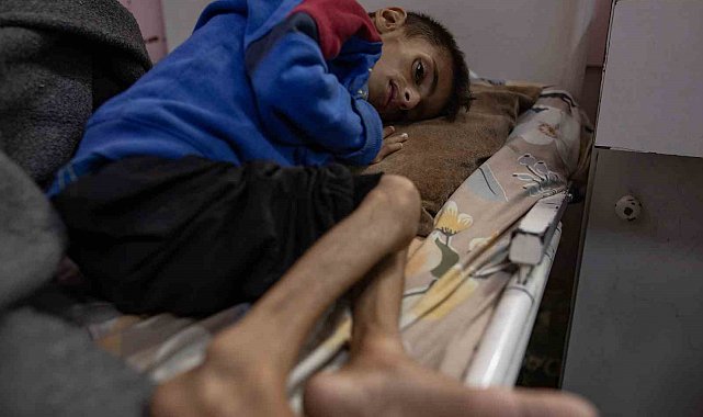 Gazze'de son 24 saatte 10 sivil açlıktan öldü