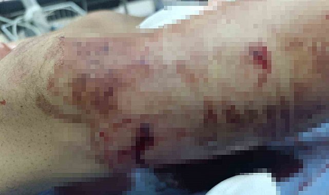 Muş'ta ayının saldırdığı çocuk yaralandı