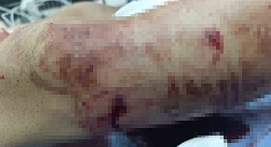 Muş'ta ayının saldırdığı çocuk yaralandı