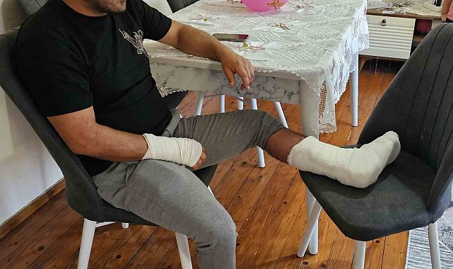 Sokak köpeğinin saldırısına uğradı, ayağı iki yerden kırıldı